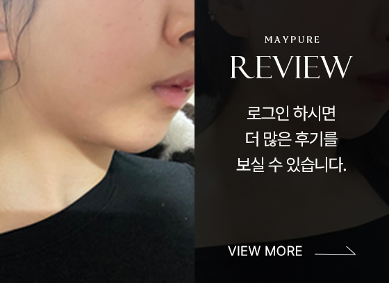 시술후기_배너_ver2_02.jpg