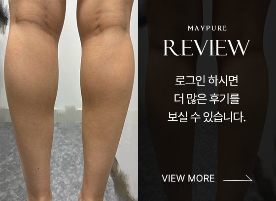시술후기_배너_ver2_03.jpg