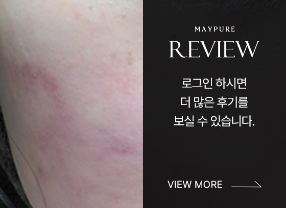 시술후기_배너_ver2_01.jpg